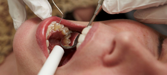 Fråga tandläkaren oktober 2012